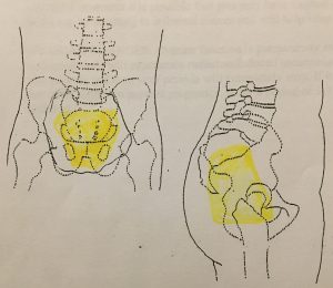 highlighted picture of the pelvic area that would be radiated