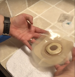 ostomy barrier with barrier strips and ring